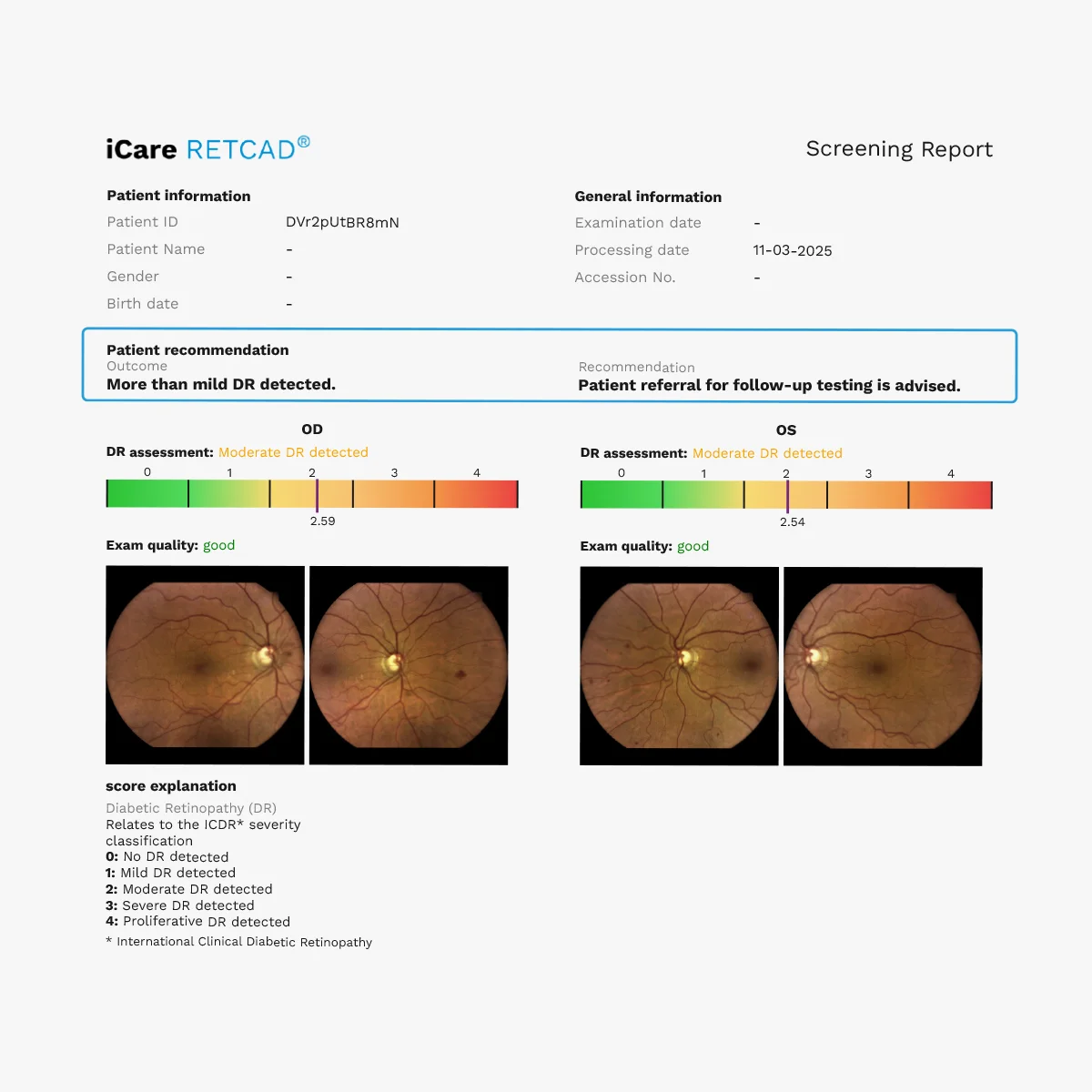 Rastreio da retinopatia diabética com o iCare ILLUME